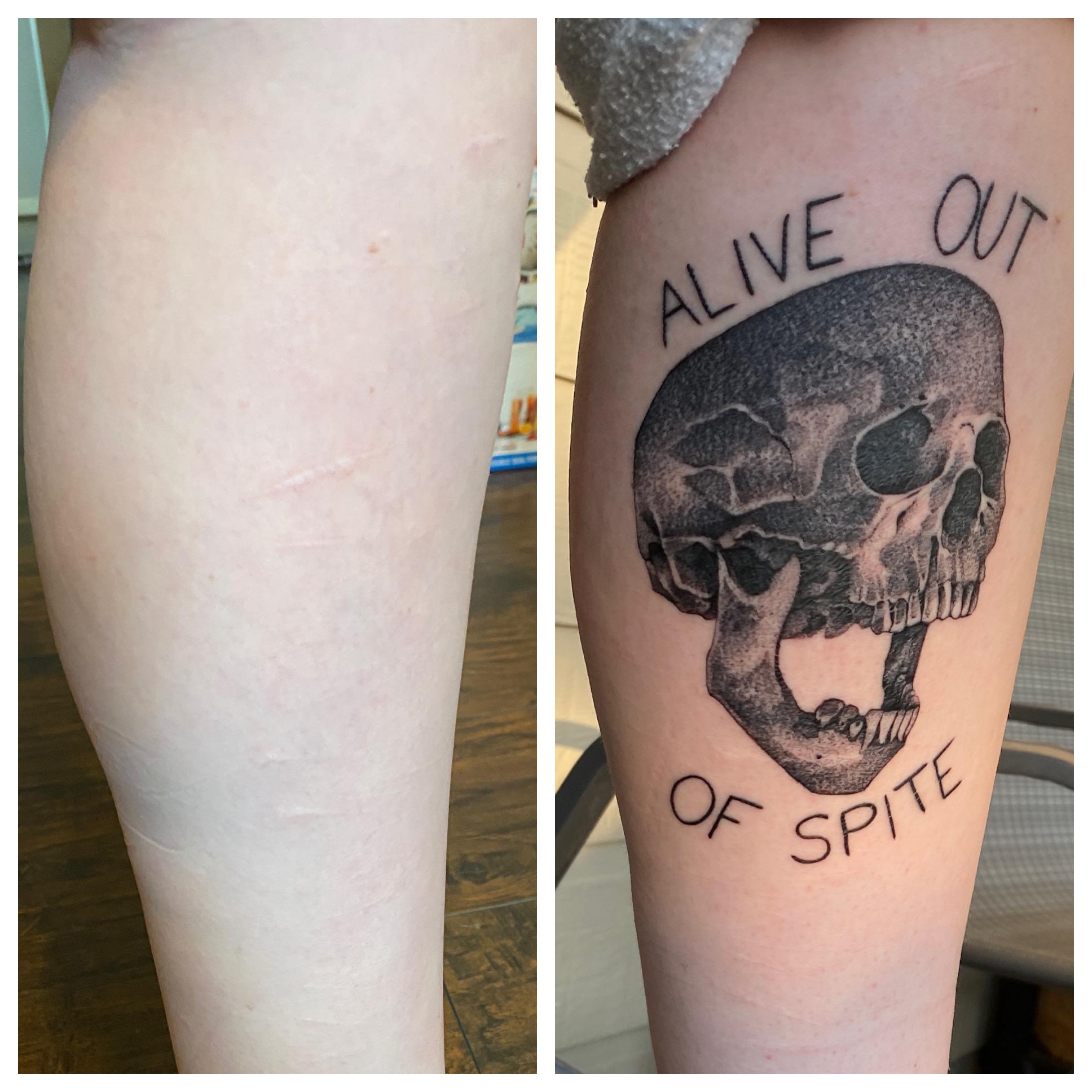 Skull Head To Cover Old Scars Sierra At Red Dagger Tattoo In Houston Tx R Tattoos