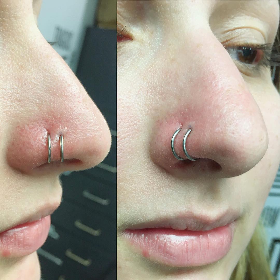 Top 90 Pictures Nose Piercing Healing Stages With Pictures Completed